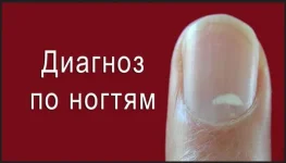 0.webp