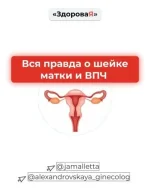 0.webp