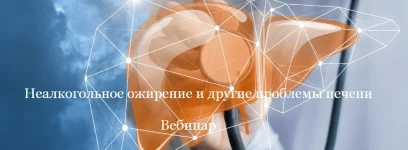 0.webp