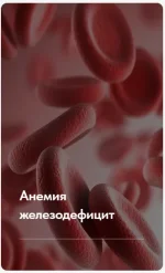 0.webp