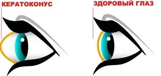 0.webp