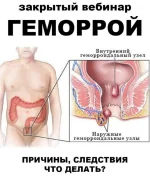 0.webp