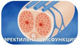 0.webp